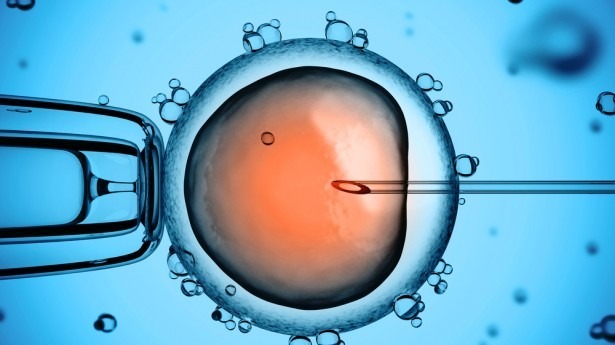 IVF